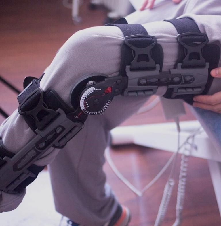 What You Need to Know About Severe Knee Injuries from a Car Accident