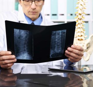 Back Injury Car Accident Lawyer